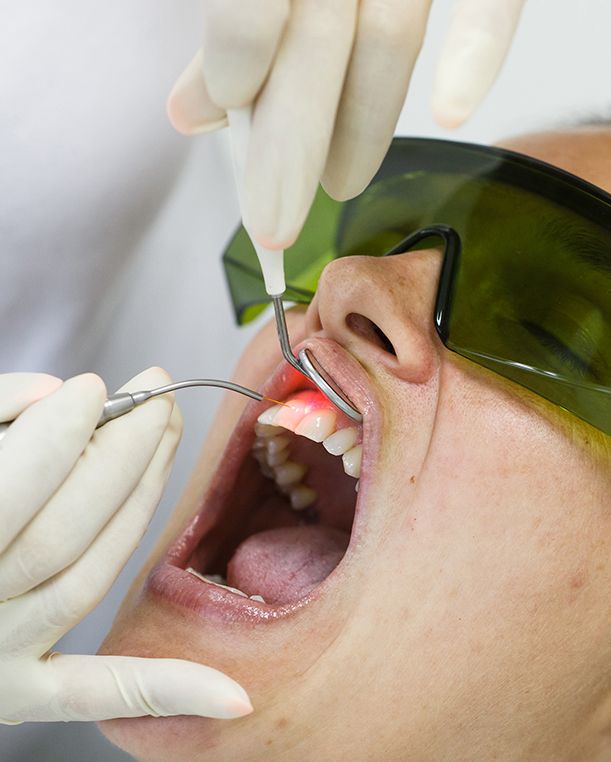 Laser Dentistry