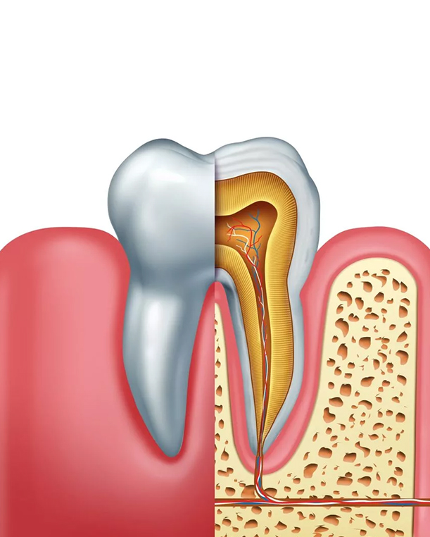 Root Canal Treatment