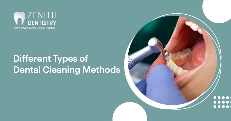Different Types of Dental Cleaning Methods