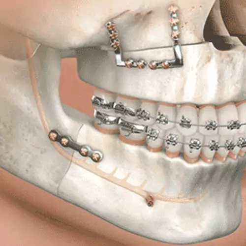 Oral and Maxillofacial